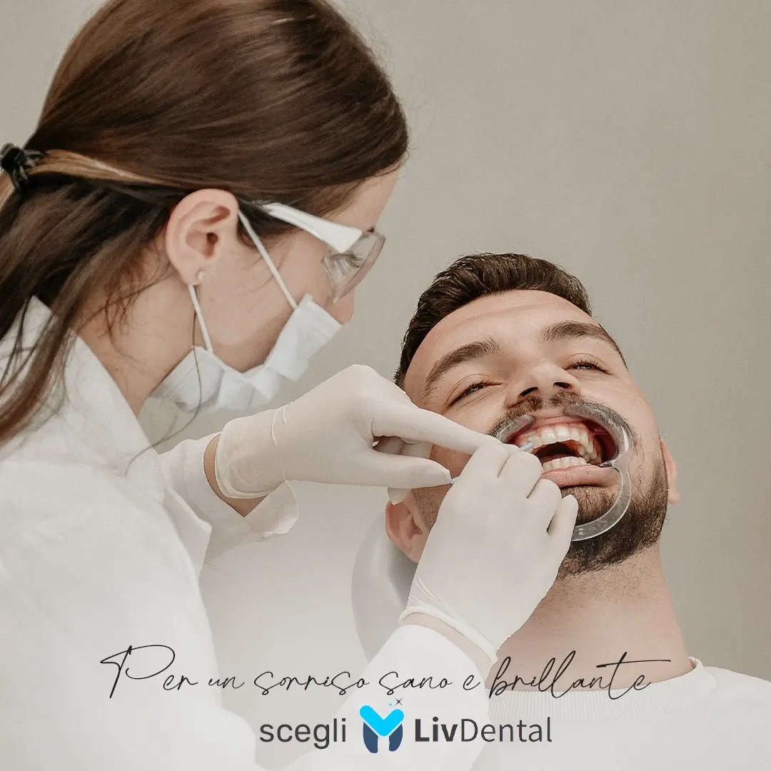 Sbiancamento Dentale Professionale